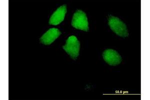 Immunofluorescence of purified MaxPab antibody to HIRA on HeLa cell. (HIRA 抗体  (AA 1-1017))