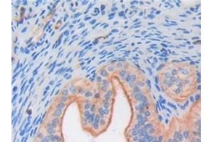Detection of FGF6 in Mouse Ovary Tissue using Polyclonal Antibody to Fibroblast Growth Factor 6 (FGF6) (FGF6 抗体  (AA 39-208))