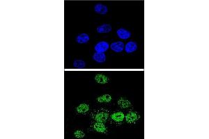 Confocal immunofluorescent analysis of MEF2A Antibody (Center) (ABIN653206 and ABIN2842748) with Hela cell followed by Alexa Fluor® 488-conjugated goat anti-rabbit lgG (green). (MEF2A 抗体  (AA 453-479))