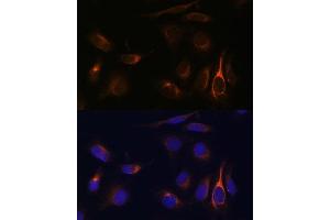 Immunofluorescence analysis of U-2 OS cells using VMP1 Polyclonal Antibody (ABIN7271283) at dilution of 1:100 (40x lens). (VMP1 抗体  (C-Term))