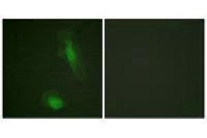 Immunofluorescence analysis of HeLa cells, using Akt (Ab-129) antibody. (AKT1 抗体  (Ser129))