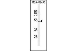 Western blot analysis of GFRAL Antibody (C-term) in MDA-MB435 cell line lysates (35ug/lane).