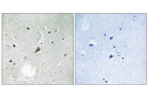 Immunohistochemistry analysis of paraffin-embedded human brain tissue using PYK2 (Phospho-Tyr579) antibody. (PTK2B 抗体  (pTyr579))