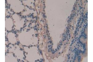 DAB staining on IHC-P; Samples: Rat Lung Tissue (Periostin 抗体  (AA 659-810))