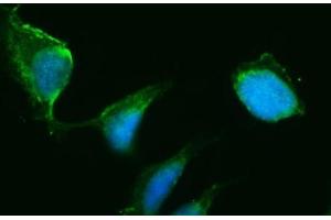 IF analysis of HSD3B1 using anti-HSD3B1 antibody (ABIN7600266).