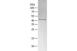 Western Blotting (WB) image for Acyl-CoA Dehydrogenase, Long Chain (ACADL) (AA 31-430) protein (His tag) (ABIN7121678) (ACADL Protein (AA 31-430) (His tag))