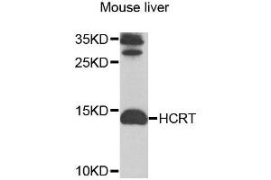 Western blot analysis of extracts of mouse liver, using HCRT antibody (ABIN6003553) at 1/1000 dilution. (Orexin 抗体)