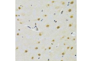 Immunohistochemistry of paraffin-embedded rat brain using DDB1 Antibody. (DDB1 抗体)