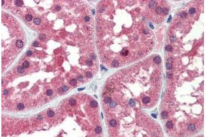 Immunohistochemistry (Paraffin-embedded Sections) (IHC (p)) image for anti-Isocitrate Dehydrogenase 1 (NADP+), Soluble (IDH1) (AA 290-339) antibody (ABIN6741619)