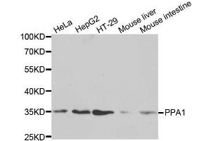 Western blot analysis of extracts of various cell lines, using PPA1 antibody. (Pyrophosphatase (Inorganic) 1 (PPA1) (AA 1-289) 抗体)