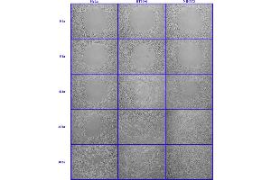 Cellular Assay (CA) image for Radius™ 24-Well Cell Migration Assay (ABIN2344873)