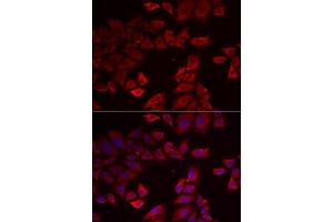 Immunofluorescence analysis of MCF7 cells using SEPHS1 antibody . (SEPHS1 抗体  (AA 1-392))