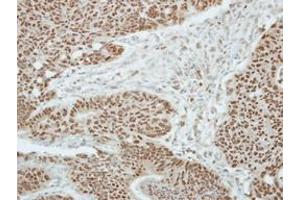 Image no. 1 for anti-Zinc Finger and BTB Domain Containing 9 (ZBTB9) (AA 1-206) antibody (ABIN1501798) (ZBTB9 抗体  (AA 1-206))