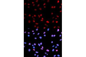Immunofluorescence analysis of U2OS cells using Phospho-RB-S795 antibody (ABIN5969932). (Retinoblastoma 1 抗体  (pSer795))