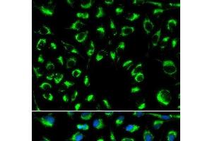 Immunofluorescence analysis of MCF-7 cells using PPP4C Polyclonal Antibody (PPP4C 抗体)
