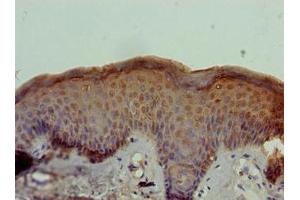 Immunohistochemistry of paraffin-embedded human skin tissue using ABIN7170811 at dilution of 1:100 (STOX1 抗体  (AA 559-858))