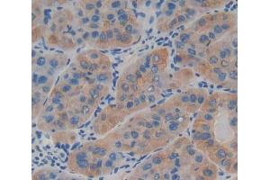 IHC-P analysis of Kidney tissue, with DAB staining. (LAMb4 抗体  (AA 1543-1759))
