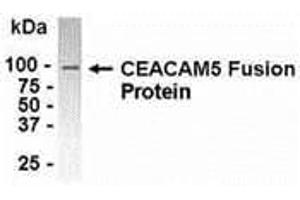 Western Blotting (WB) image for anti-Carcinoembryonic Antigen-Related Cell Adhesion Molecule 5 (CEACAM5) (AA 460-600) antibody (ABIN2468129) (CEACAM5 抗体  (AA 460-600))