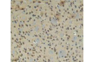 IHC-P analysis of Mouse Brain Tissue, with DAB staining. (CTGF 抗体  (AA 245-346))