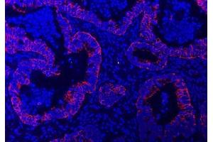 IF analysis of TRAM1L1 using anti-TRAM1L1 antibody (ABIN7602939).
