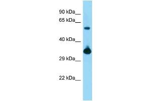 WB Suggested Anti-Bmi1 Antibody   Titration: 1. (BMI1 抗体  (Middle Region))
