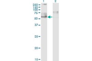 Western Blot analysis of IKZF5 expression in transfected 293T cell line by ZNFN1A5 monoclonal antibody (M01), clone 1B6. (IKZF5 抗体  (AA 2-100))