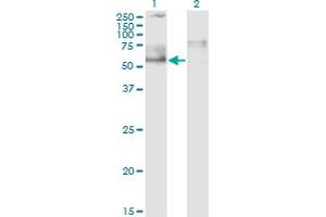 Western Blot analysis of IKZF5 expression in transfected 293T cell line by ZNFN1A5 monoclonal antibody (M01), clone 1B6.