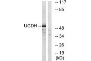 Western blot analysis of extracts from COLO cells, using UGDH Antibody. (UGDH 抗体  (AA 391-440))