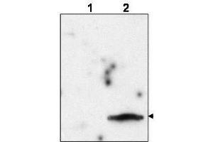Western blot using  affinity purified anti-FIV Matrix Protein p15 to detect p15 in the culture supernatant of FIV-infected feline CrFK cells (lane 2, arrowhead). (Feline Immunodeficiency Virus Matrix (MA) (FIV p15) (Internal Region) 抗体)