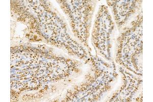 ABIN7094336 and ABIN7098383 at 1/100 staining Rat colon tissue by IHC-P. (Ceramide Synthase 2 抗体  (C-Term))