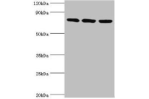 Western blot All lanes: DNA replication licensing factor MCM5 antibody at 3 μg/mL Lane 1: Hela whole cell lysate Lane 2: MCF-7 whole cell lysate Lane 2: Mouse thymus tissue Secondary Goat polyclonal to rabbit IgG at 1/10000 dilution Predicted band size: 82 kDa Observed band size: 82 kDa (MCM5 抗体  (AA 1-230))