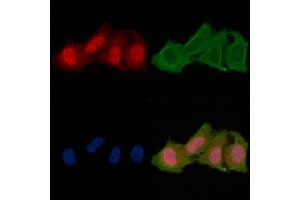 ABIN6256701 and ABIN6278650 staining Hela cells(24h of starvation treatment) by IF/ICC. (CSNK1A1 抗体  (pTyr294))