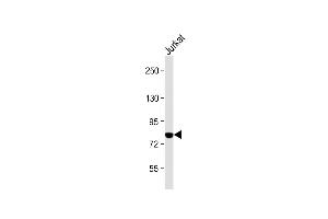 Anti-PKC theta Antibody (C-term) at 1:2000 dilution + Jurkat whole cell lysate Lysates/proteins at 20 μg per lane. (PKC theta 抗体  (C-Term))