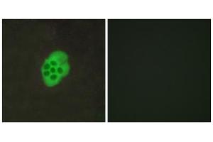 Immunofluorescence analysis of MCF-7 cells, using HTR4 antibody. (Serotonin Receptor 4 抗体  (Internal Region))
