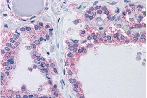 Immunohistochemistry (IHC) image for anti-ArfGAP with GTPase Domain, Ankyrin Repeat and PH Domain 2 (AGAP2) (Internal Region) antibody (ABIN570975)