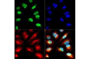 Immunofluorescence of Histone H3 [ac Lys9/phosphor Ser10]: Histone H3 K9-Ac/pS10 antibody was tested in HeLa cells with DyLight 488 (green). (Histone 3 抗体  (H3K9ac, pSer10))
