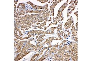 Anti-cardiac Troponin C antibody, IHC(P) IHC(P): Rat Cardiac Muscle Tissue (TNNC1 抗体  (N-Term))