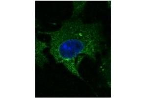 Immunofluorescence (IF) image for anti-CD63 (CD63) (AA 120-175) antibody (ABIN1440014)