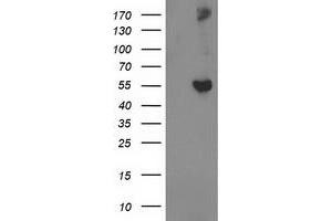 Western Blotting (WB) image for anti-Glucosidase, Beta, Acid 3 (Cytosolic) (GBA3) (AA 1-150), (AA 370-469) antibody (ABIN1490585)