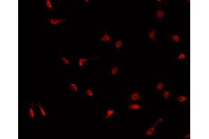 ABIN6268972 staining K-562 cells by IF/ICC. (Cyclin H 抗体  (pThr315))