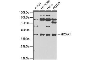 Western blot analysis of extracts of various cell lines, using HOX antibody (ABIN6131766, ABIN6141930, ABIN6141931 and ABIN6222663) at 1:1000 dilution. (HOXA1 抗体  (AA 75-205))