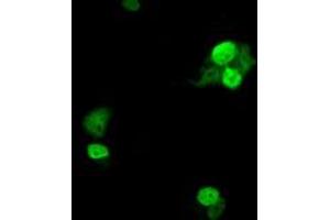 Anti-UBE2T mouse monoclonal antibody (ABIN2453760) immunofluorescent staining of COS7 cells transiently transfected by pCMV6-ENTRY UBE2T (RC200748). (Ube2t 抗体)