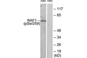 Western blot analysis of extracts from K562 cells, using C-RAF (Phospho-Ser259) Antibody. (RAF1 抗体  (AA 225-274))