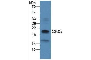 Detection of DUSP3 in Rat Heart Tissue using Monoclonal Antibody to Dual Specificity Phosphatase 3 (DUSP3)