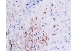 Immunohistochemistry (Paraffin-embedded Sections) (IHC (p)) image for anti-Zinc Finger, Matrin-Type 3 (ZMAT3) (AA 70-120) antibody (ABIN722781)