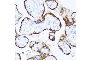 Immunohistochemistry of paraffin-embedded human placenta using Casein Kinase 1 alpha (Casein Kinase 1 alpha (CSNK1)) antibody (6225) at dilution of 1:100 (40x lens). (CSNK1A1 抗体  (AA 100-200))