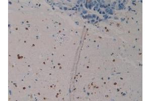 Immunohistochemistry (IHC) image for anti-S100 Calcium Binding Protein P (S100P) (AA 1-95) antibody (ABIN7434620)