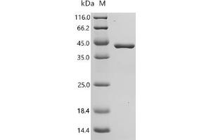 Chitinase 3-Like 1 (Cartilage Glycoprotein-39) (CHI3L1) (AA 22-383), (full length) (Active) protein (His tag)