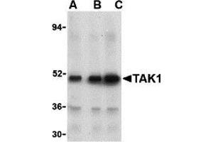 Western Blotting (WB) image for anti-Nuclear Receptor Subfamily 2, Group C, Member 2 (NR2C2) (N-Term) antibody (ABIN1031601) (TR4 抗体  (N-Term))