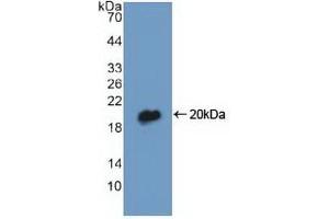 Detection of Recombinant DBI, Human using Polyclonal Antibody to Diazepam Binding Inhibitor (DBI) (Diazepam Binding Inhibitor 抗体  (AA 1-104))